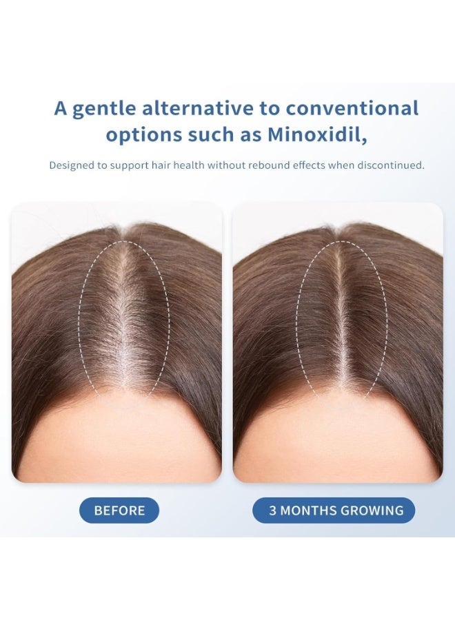 HOEGOA Hair Growth Serum Roll On丨with 3% Rosemary, 3% Redensyl, 2% Anagain, 1% DHQ, Biotin & Niacinamide | Stimulates Hair Follicles丨Hair Loss Treatment & Strengthens丨for Men & Women丨30ml - Image 3